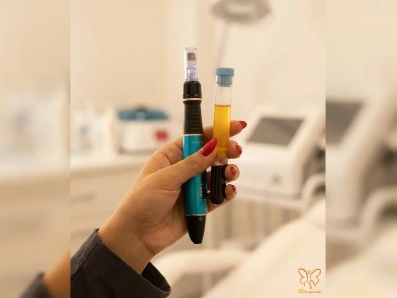  میکرونیدلینگ با پی آر پی (PRP) راز پوستی جوان و صاف 