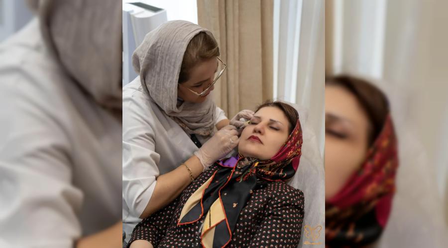 درمان تیرگی و چروک دور چشم با جالپرو یانگ آی در کلینیک شاپرک طلایی مشهد 
