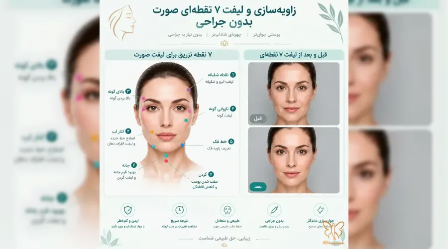 زاویه‌سازی و لیفت ۷ نقطه‌ای صورت بدون جراحی در مشهد + قیمت و عکس قبل و بعد